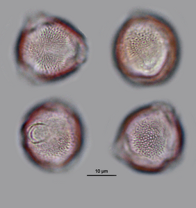 Pollen vom Götterbaum (Vergrößert das Bild in einem Dialog Fenster)