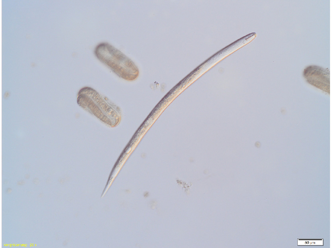 Mikroskopische Aufnahme von Eiern und einer Larve